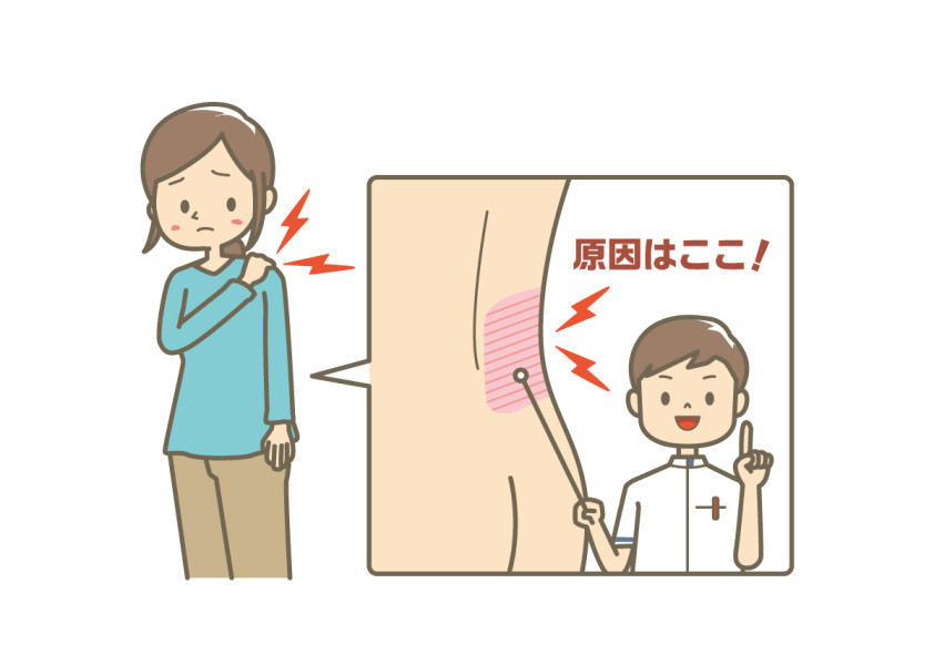 腰