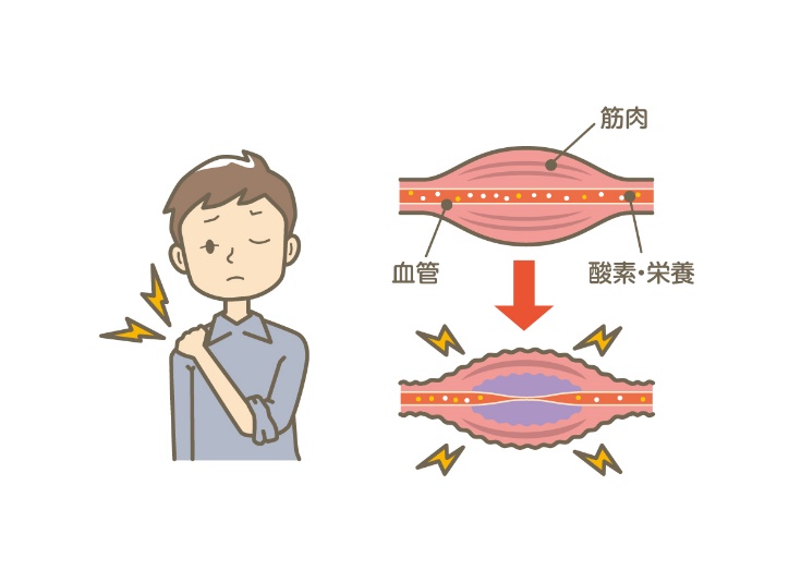 筋肉